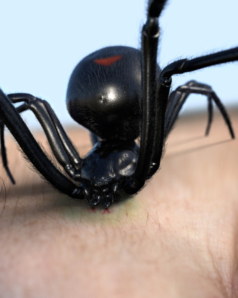 Black Widow spider stinging