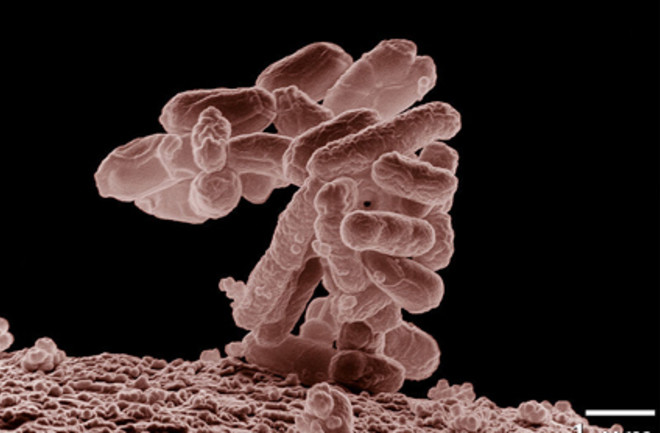 E_coli.jpg