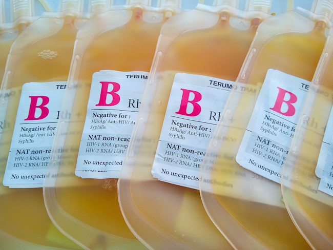 Plasma in a blood bag - shutterstock