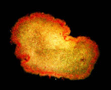placozoan.jpg