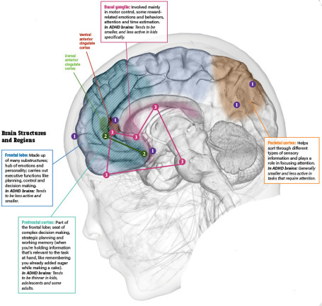 what-we-know-about-the-causes-and-symptoms-of-adhd-discover-magazine