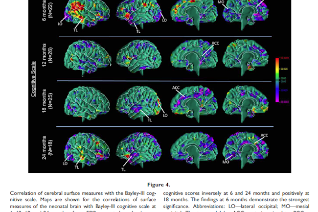 cognition_vs_brain.png