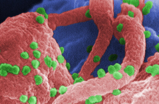 hiv-virus-on-lymphocyte.jpg