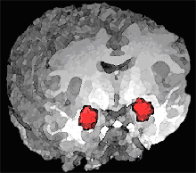 Amygdala_position.png