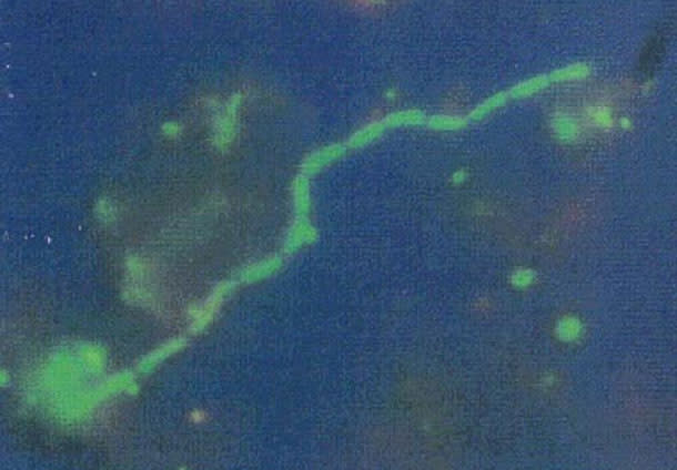 Deep_sea_bacteria.jpg
