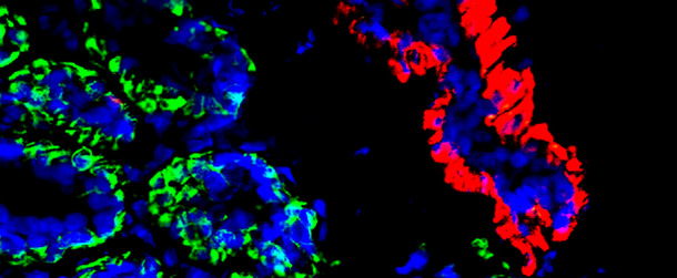 Breast_stem_cells.jpg