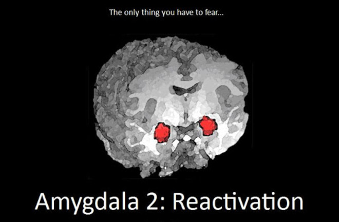 Amygdala Neuroskeptic - NEEDS CREDIT