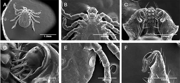 Tick_SEM.jpg