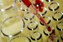 blood-test-sample.jpg