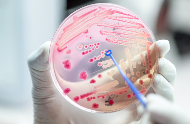 Bacteria on Plate - Shutterstock