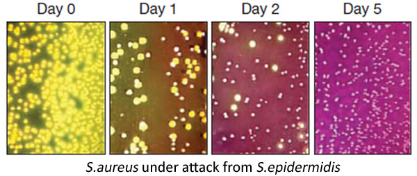 S.epidermidis.jpg