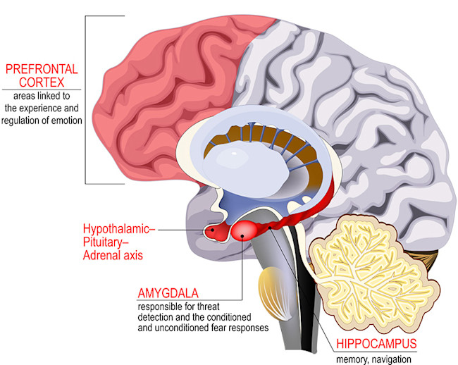 Post Traumatic Stress Syndrome