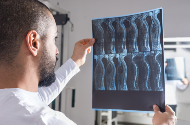 Radiologist analysing X-ray image with human spine in consulting room