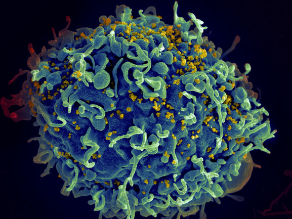 HIV - NIH