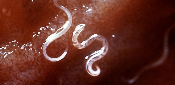 Hookworm.jpg