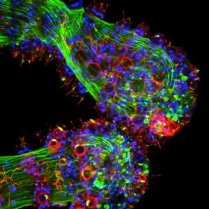 1330684909849-hydra_opsin-300x300.jpg