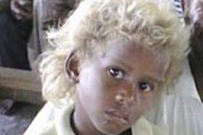 Genetics Of Hair Color Discover Magazine