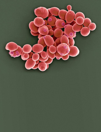 saccharomyces-cerevisiae.jpg