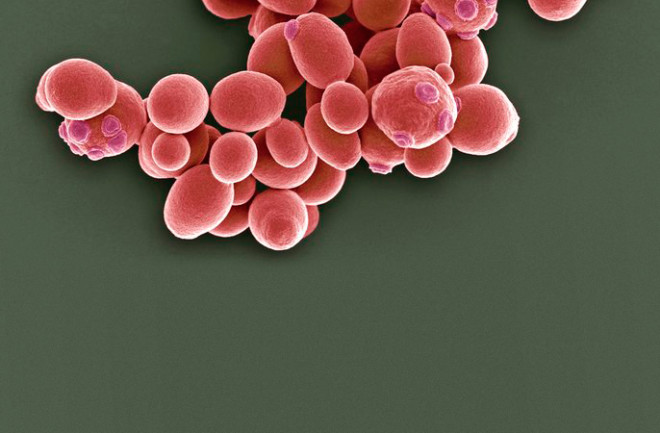 saccharomyces-cerevisiae.jpg