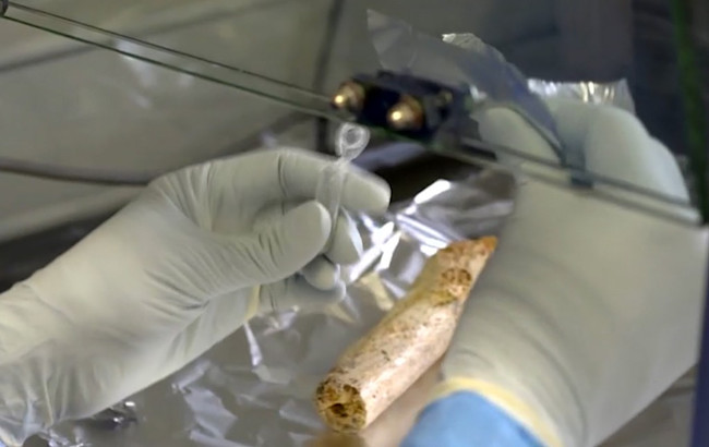 bone-analysis-1024x646.jpg