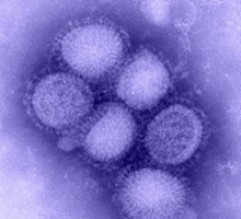 swine-flu-virus1.jpg