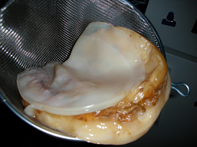 scoby