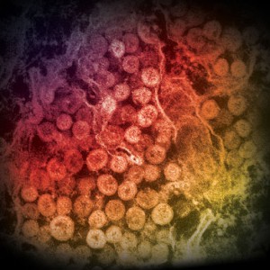 MERS-cytoplasm-300x300.jpg