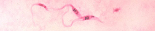 Trypanosome-cruzi.jpg