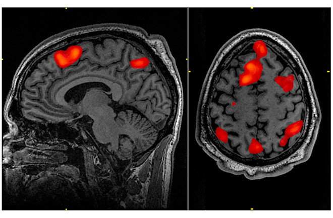 اسکن FMRI در حین انجام وظایف حافظه کاری