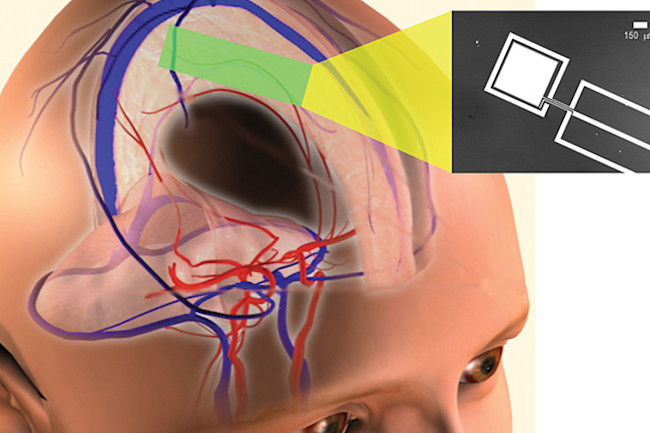 brain-sugar.jpg