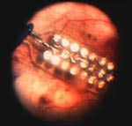 sight_array.jpg