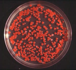 A culture of Serratia marcescens. Image: Brudersohn. Click for source.