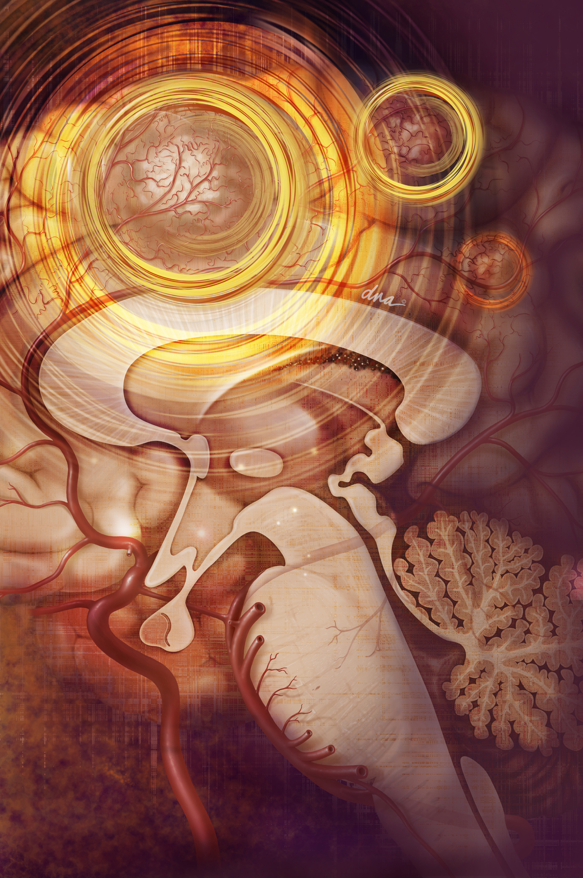 Tumor Illustration - Science Source