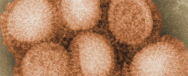 H1N1.jpg
