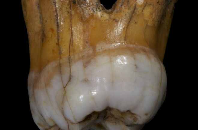 molar.jpg