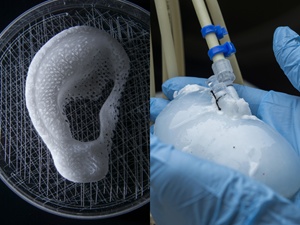 ear scaffolds