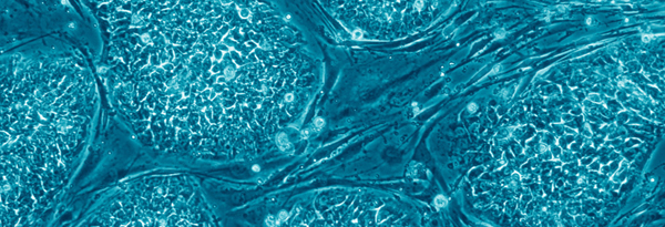 Embryonic-stem-cells.jpg