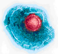 shingles sm