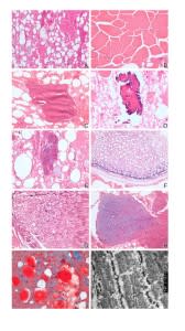 fig1-168x300.jpg