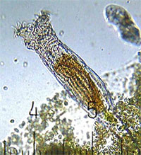 Bdelloid_rotifer.jpg
