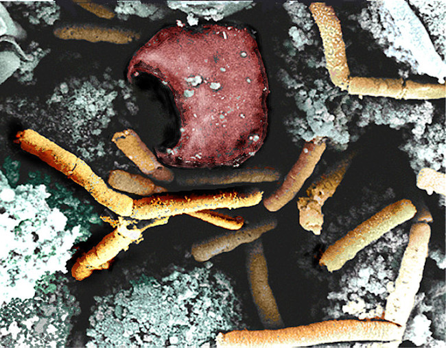 767px-Anthrax_color_enhanced_micrograph.jpg