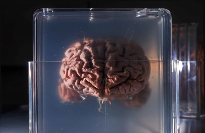 Studying a brain in jar 