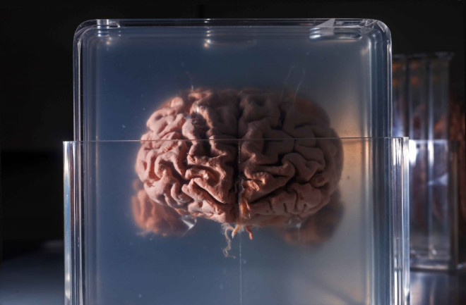 Brain in Jar - Shutterstock