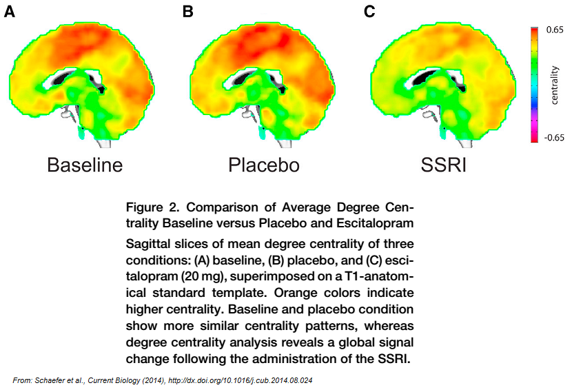 ssri_brain_schaefer.png