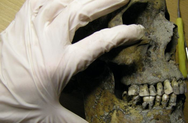 Examining Viking Teeth 
