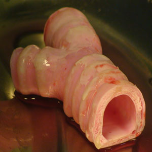 trachea.jpg