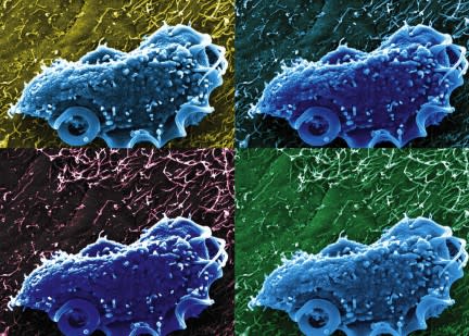 Understanding how growth rates of individual cells varies is a key priority for microbiologists. (Image: NIH/Aleksey Chudnovskiy and Miriam Merad, Icahn School of Medicine)