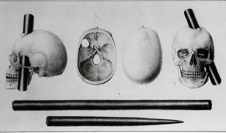 skull of phineas gage