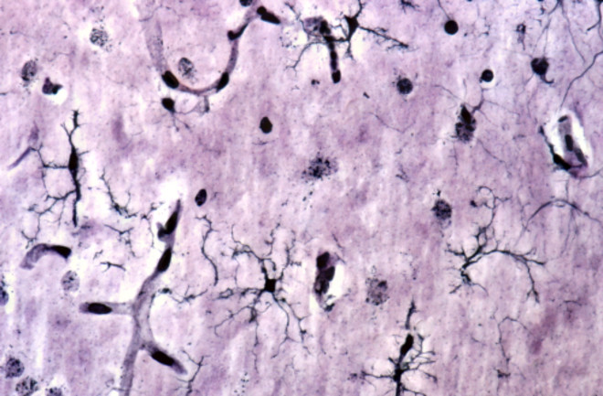 Microglia cells