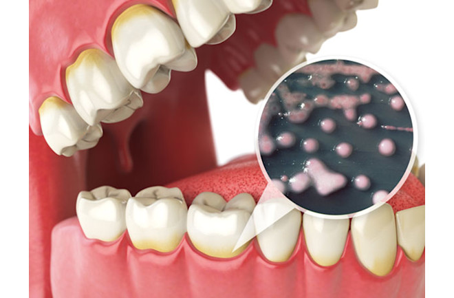 Steel Bite Pro Reviews 4